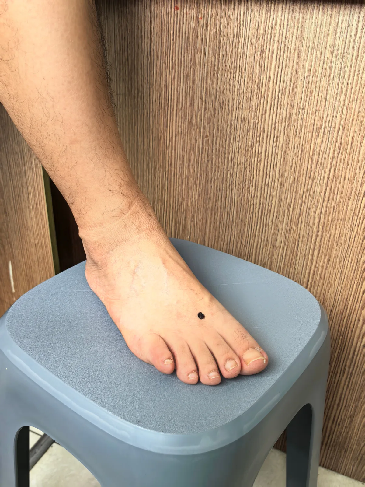 Location of the Taichong (Liver 3) acupressure point on the top of the foot, between the first and second toe tendons